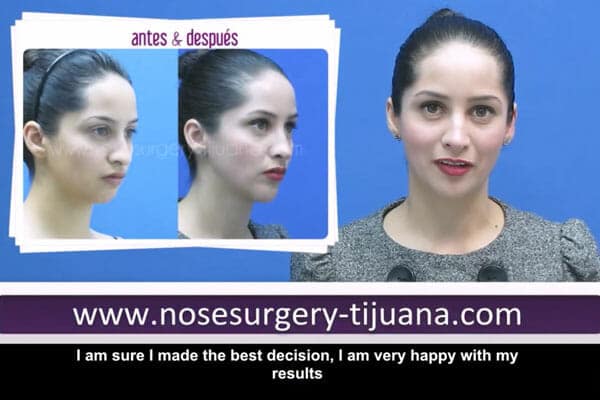 Nose Job