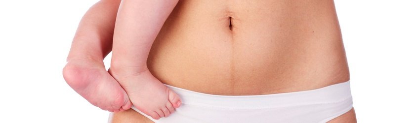 18_MAYO_QUE_TIPO_DE_TUMMY_TUCKS_ME_PUEDO_HACER
