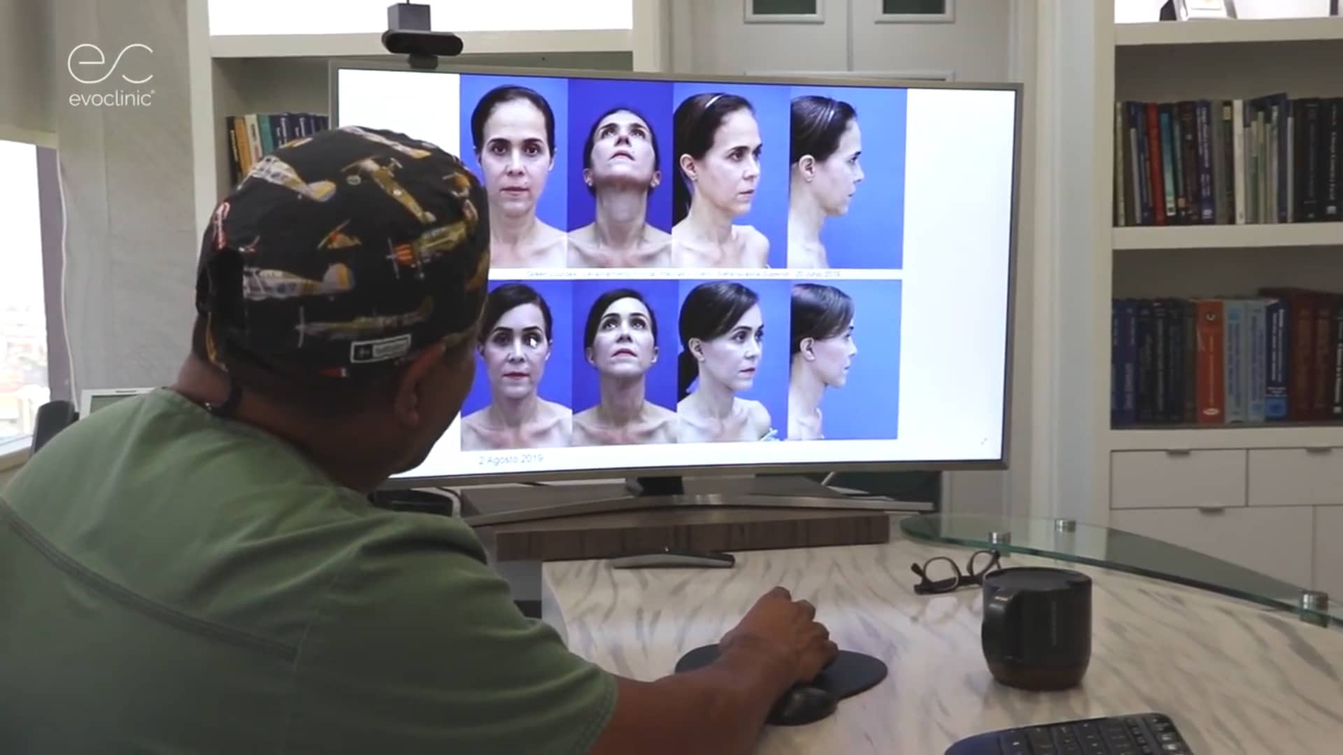 Rejuvenecimiento Facial
