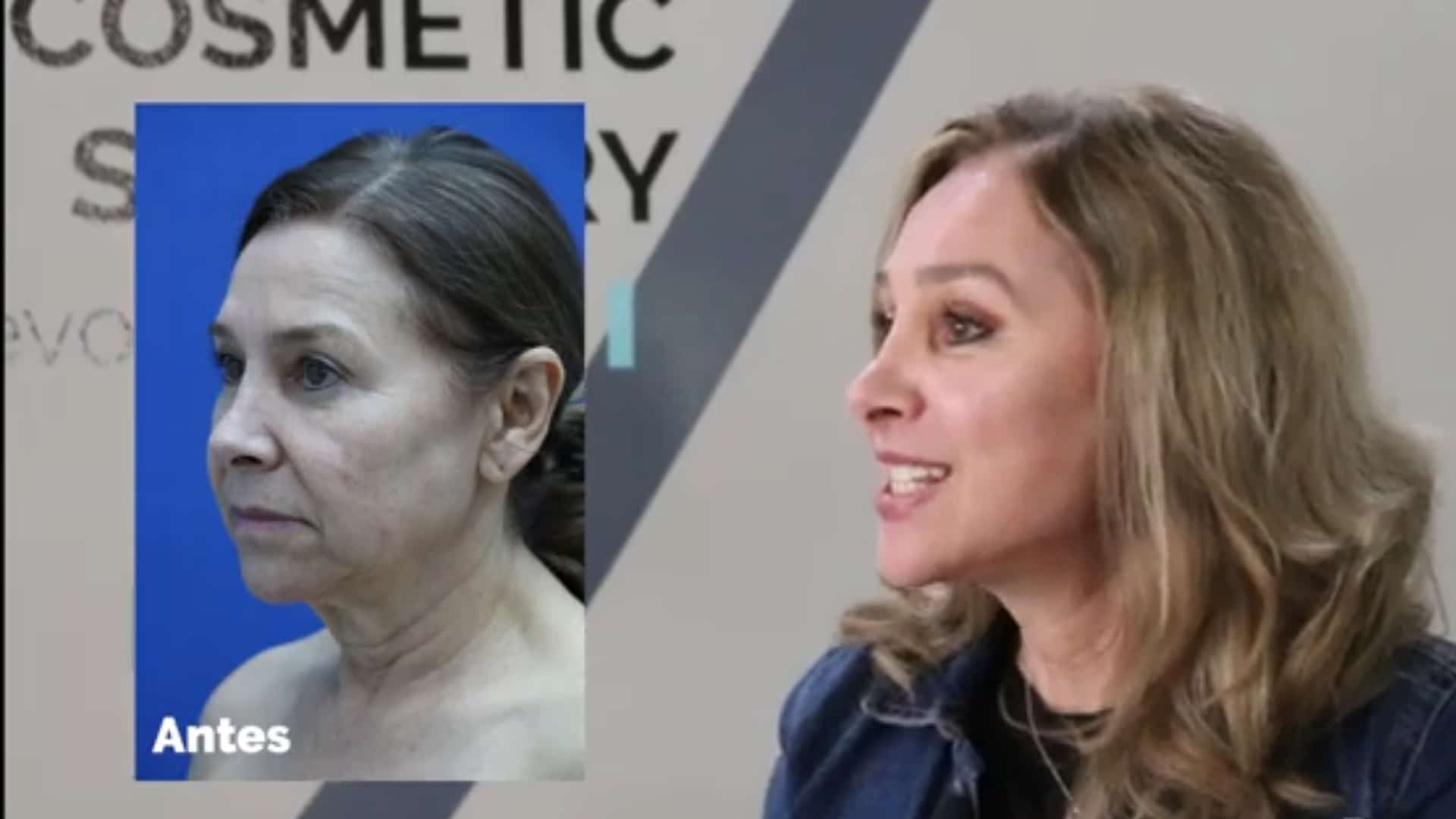 Facelit