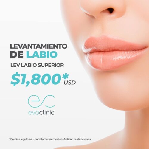LevantamientoLabio_esp
