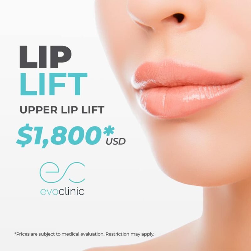 Liplift