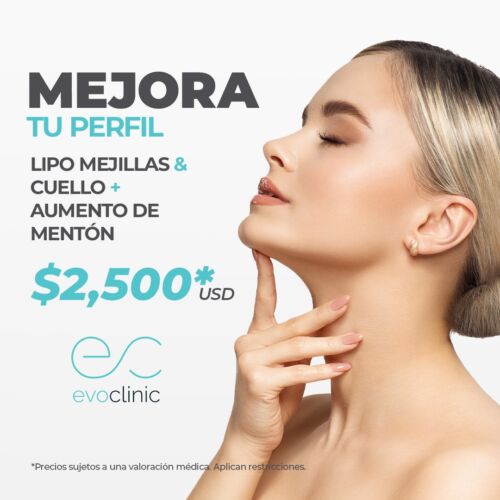 Mejoratuperfil_Esp