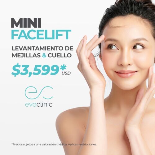 Minifacelift_esp