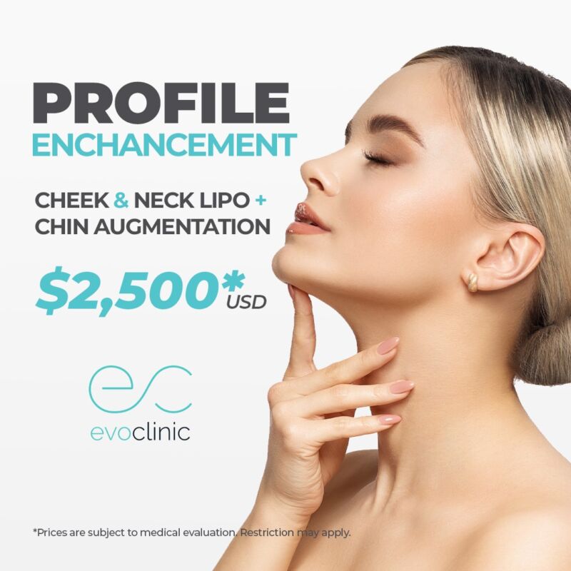ProfileEnhancement