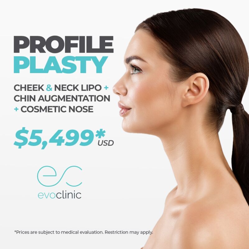 Profileplasty