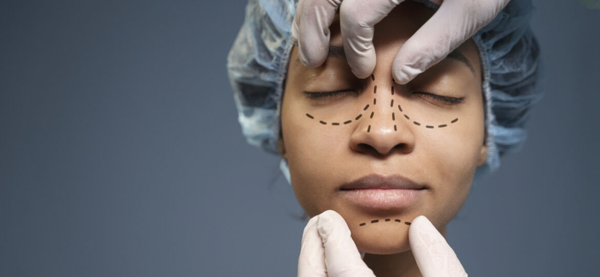 woman getting ready nose job surgery