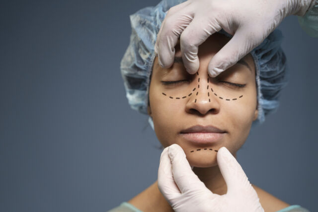 woman getting ready nose job surgery