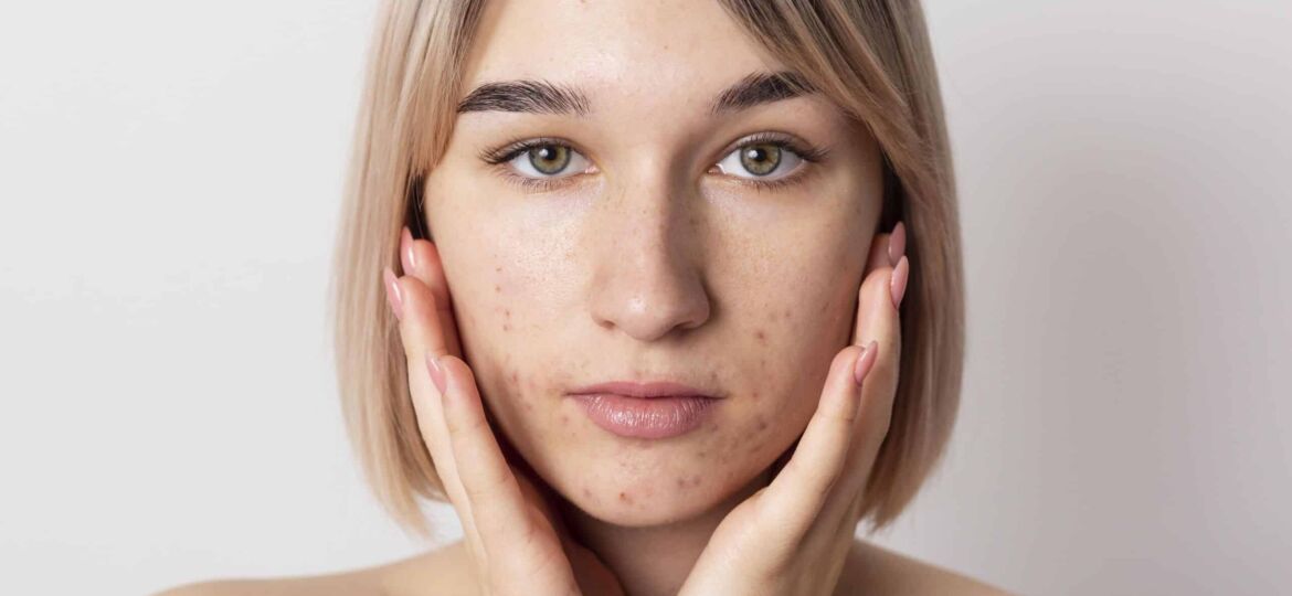 1_Facelift_2