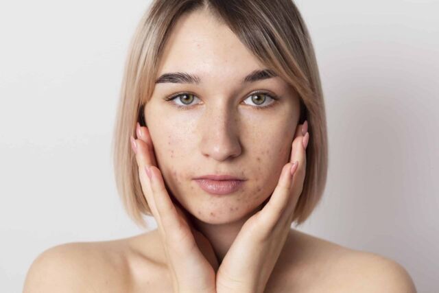1_Facelift_2