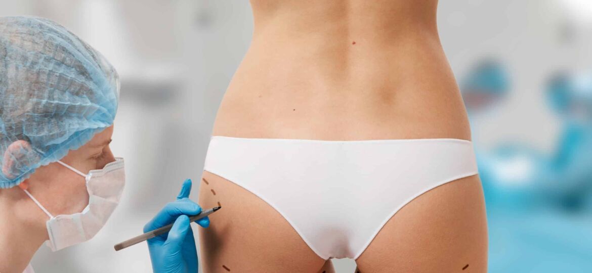 Brazilian Butt during consultation