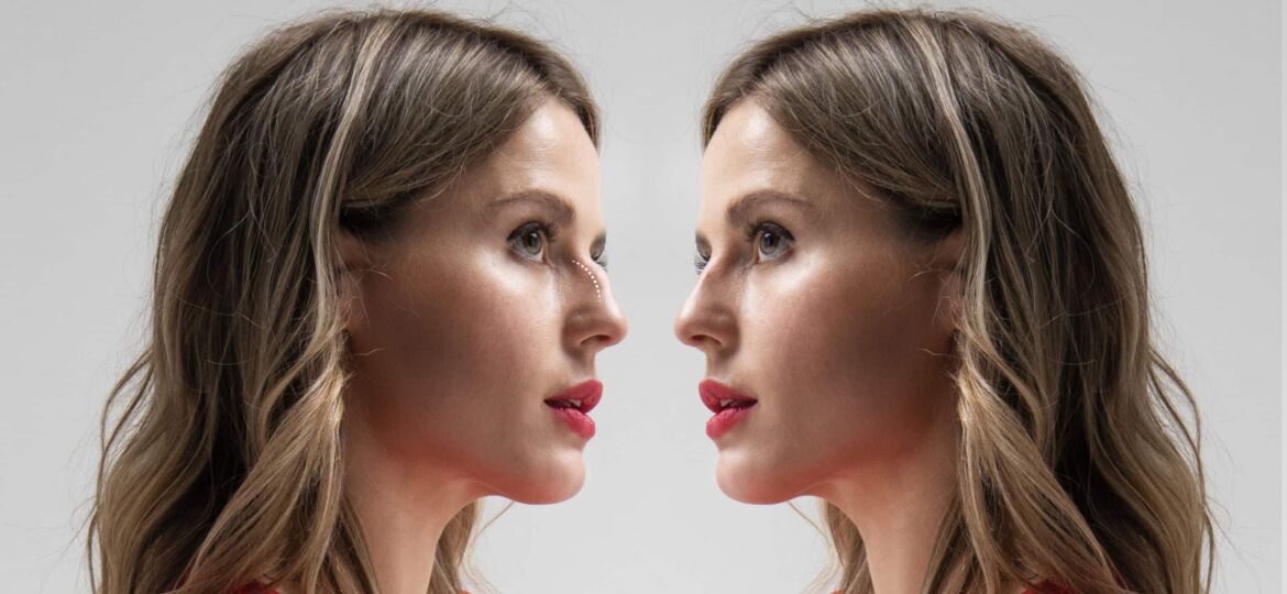 mujer-joven-antes-y-despues-de-la-vista-lateral-de-la-rinoplastia