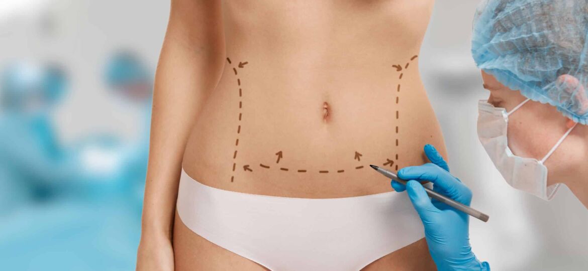 Plastic surgery doctor draw line on patient breast augmentation implant. Woman belly marked out for cosmetic surgery in surgery room interior